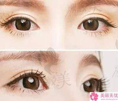 如何预约王剑医生？渠道有哪些？