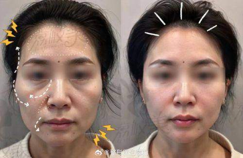 李花停项目价格表参考