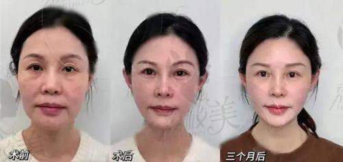 李花停在哪家医院?