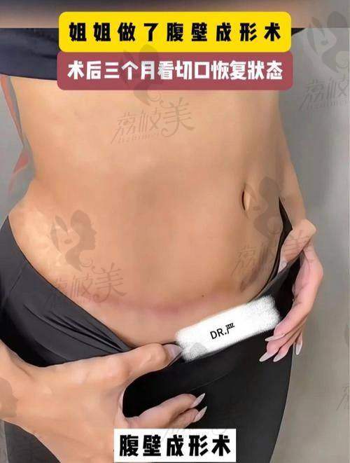 梁红伟医生的术后管理：一手设备+一手人情味