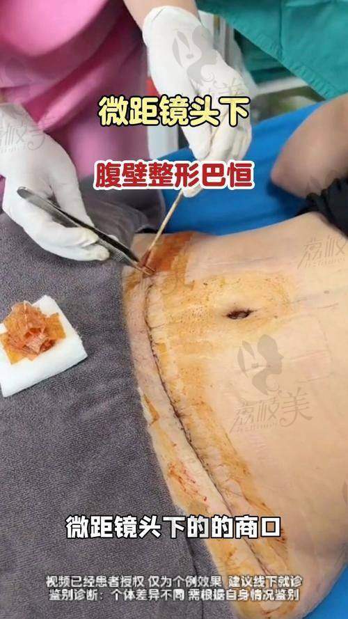 结尾总结：为啥这么多人选择梁红伟医生？你懂的