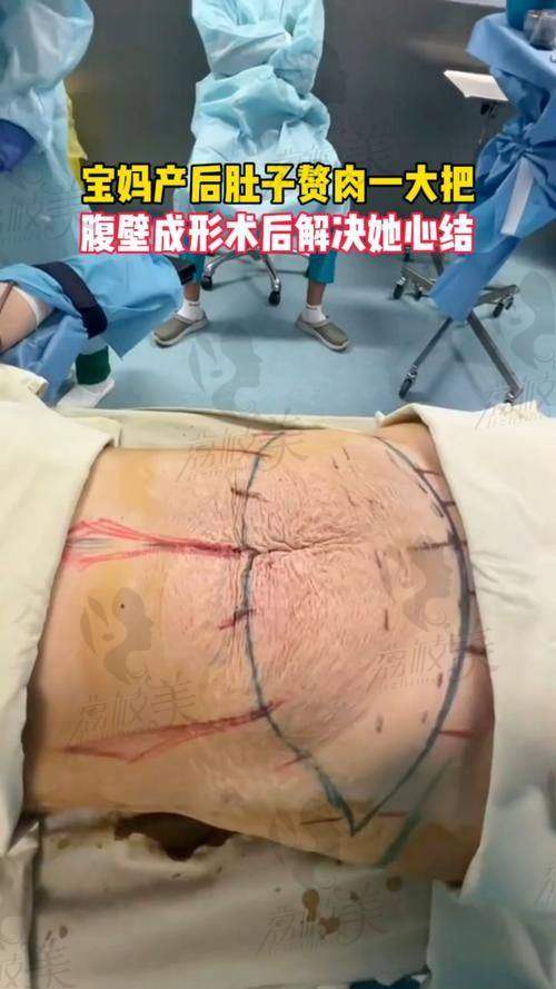 四、技术讲究——脂雕界德国工艺手工线！