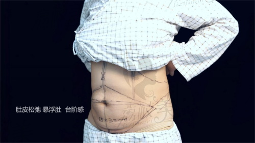 3. 个性化调整不过度追求“流水线效果”