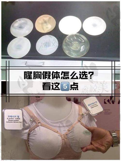 如何选择更适合自己的隆胸医生?关键看这几点