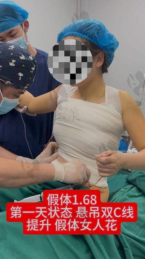 杭州艺星医生推荐:栗勇 —— 综合型隆胸方案骨干医生