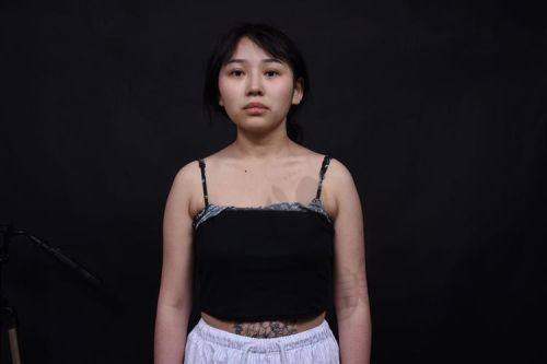 杭州艺星隆胸术后用户反馈怎么样?