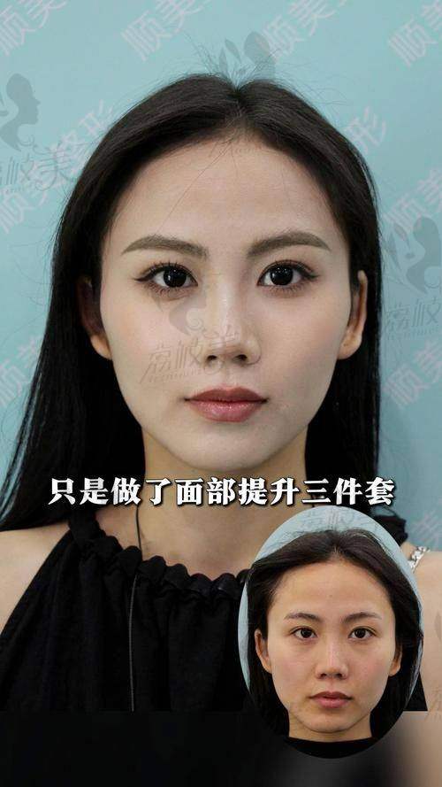 四层修复系统：层级分明，精细调控