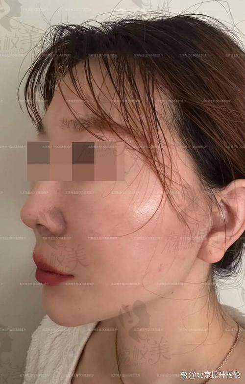 三维动态评估系统：杨胤恒辨脸第一步，拍表情还能分析馒化关键