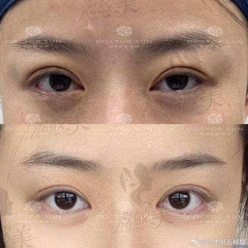 罗文婷套餐式价格体系曝光（娜美奕舒医疗美容）