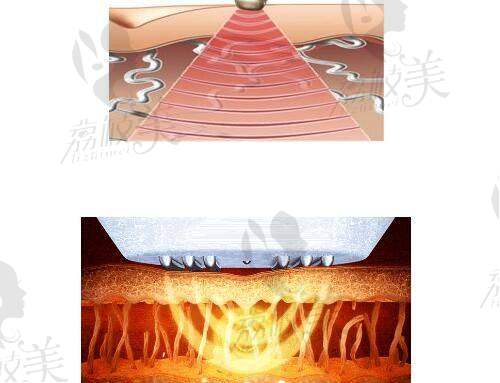 衡阳市第一人民医院整形美容科特色项目: