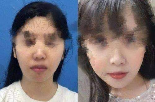 衡阳市第一人民医院整形美容科地址及乘车路线:
