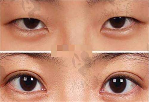 衡阳市第一人民医院整形美容科营业时间: