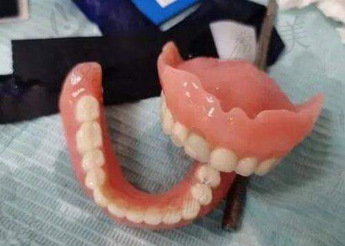 驻马店市口腔医院前十品牌排行榜之植得口腔种植牙怎么样