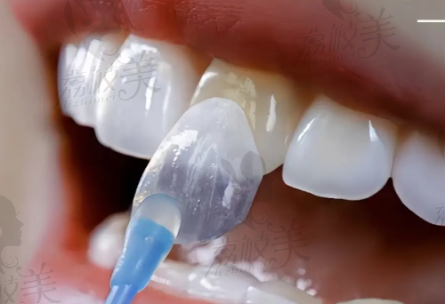 白银玉洁口腔诊所口碑怎么样?