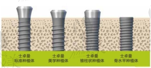 白银玉洁口腔诊所擅长什么项目: