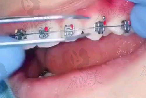 天津爱齿口腔医院是国有还是私立医院?强大医生团队是亮点