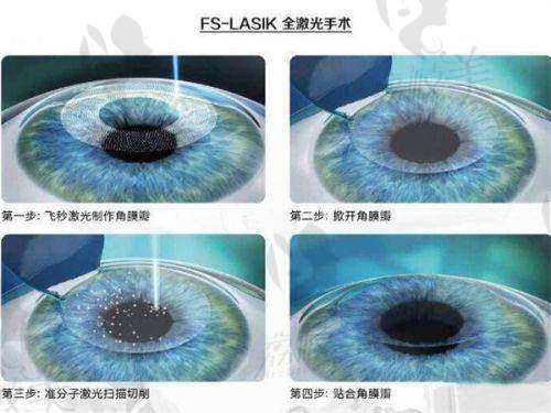 四、患者對華中科技大學(xué)同濟(jì)醫(yī)學(xué)校附屬同濟(jì)醫(yī)院眼科的評價(jià)如何？