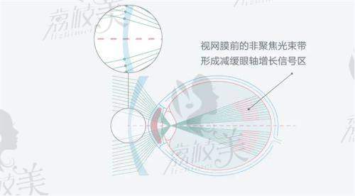 二、如皋文慈眼科醫(yī)院有哪些特色項(xiàng)目？