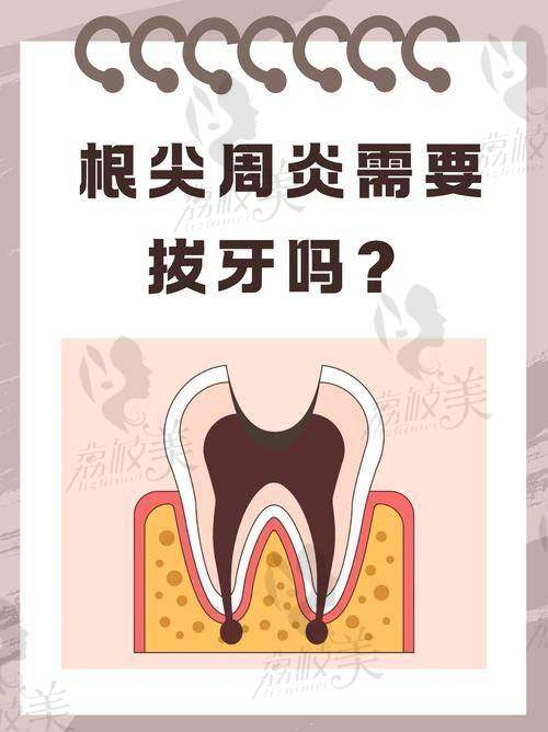 总结：为什么牙齿有问题的人都愿意选摩尔？
