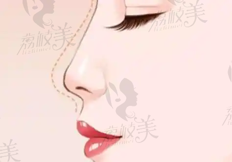 淄博美联臣纹眉限时特惠198元起，雾眉/线条眉/丝雾眉任选，打造精致眉形！