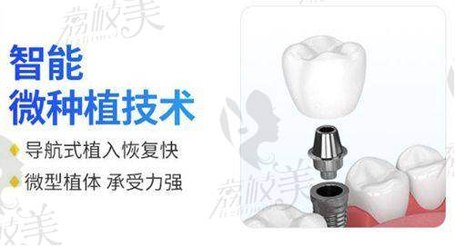 3. 半口/全口种植牙