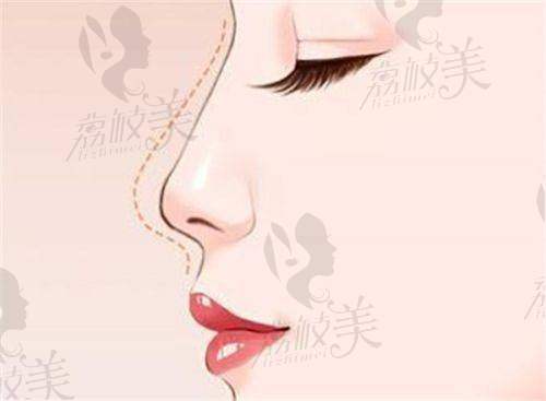 苏州美贝尔美容医院怎么样？资质正规、医生强、设备好，价格合理口碑优！