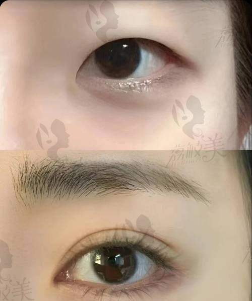 真实修复实例展示:细节见功夫