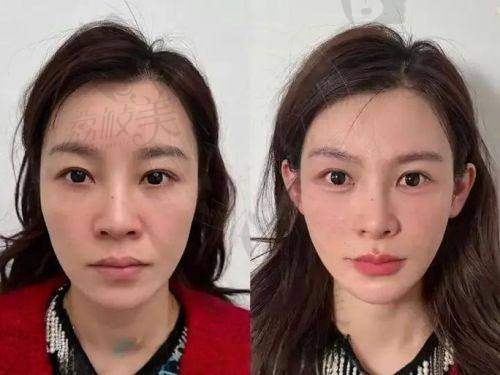 【深圳春天阳光医院轮廓抗衰中 心（宝安分院）擅长什么项目】