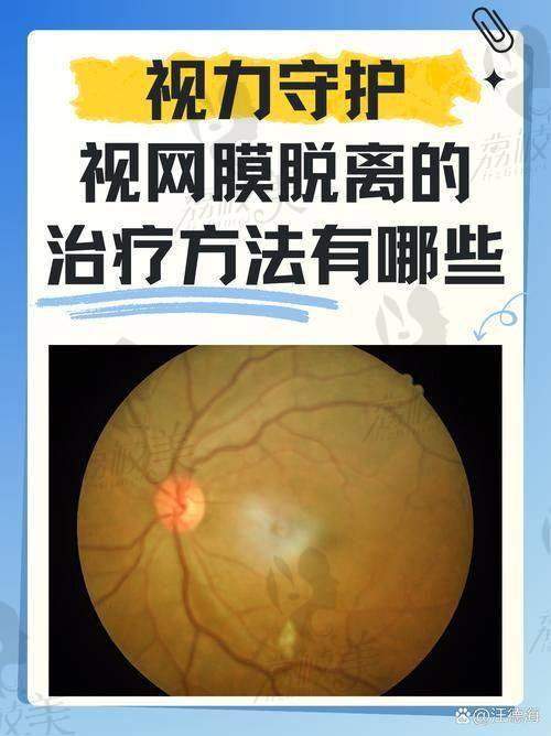【安庆市立医院眼科是私立还是公办】