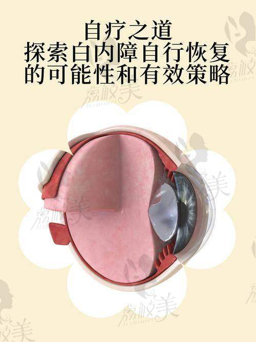 【安庆市立医院眼科是正规的吗】