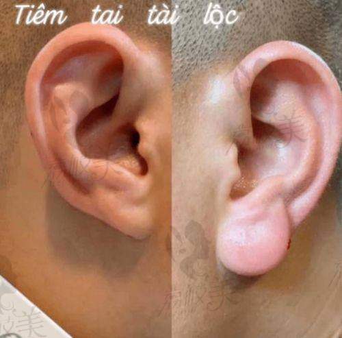 蒋海越擅长的整形项目