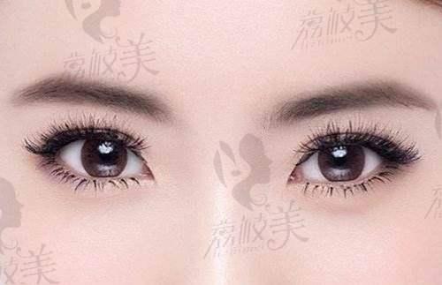 为什么成都妹儿都愿意等到张春光？修复率高、技术不翻车，才是口碑的秘密