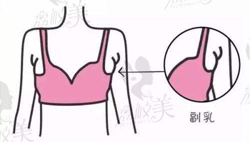 5. 北京米兰柏羽丽都医疗美容医院价格优势分析