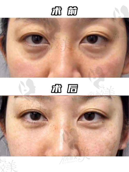 上海爱尚丽格张诗若医生简介