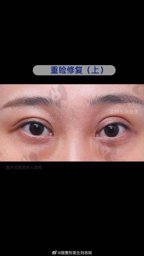 孔伟医生技术特点: