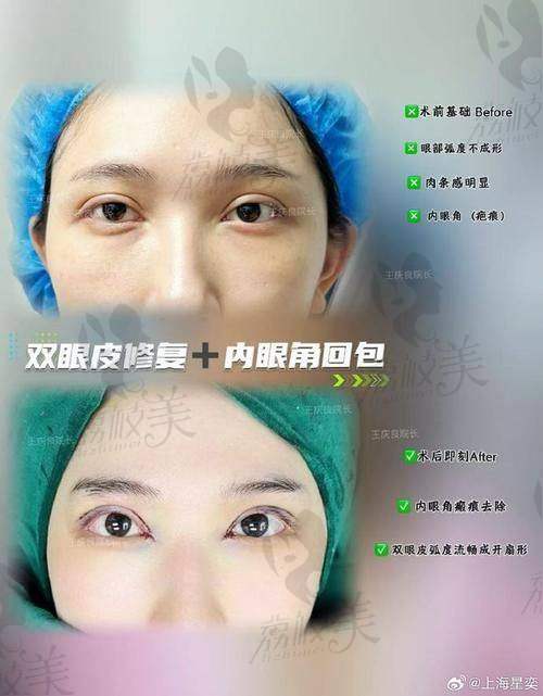 孔伟医生口碑怎么样?