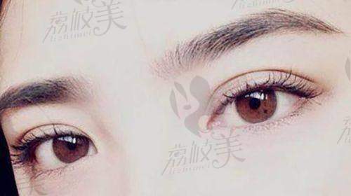 上海爱尚丽格医疗美容 杜园园医生:全眼综合修复高手,保留机制更强
