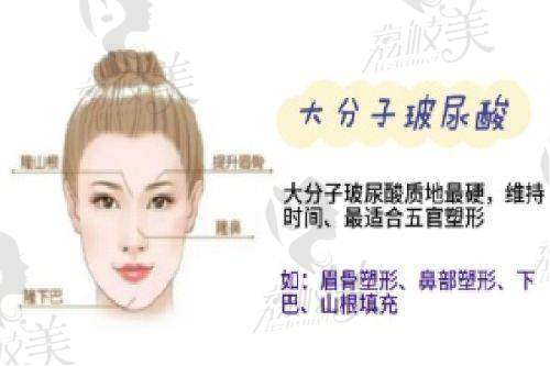 冒险小队