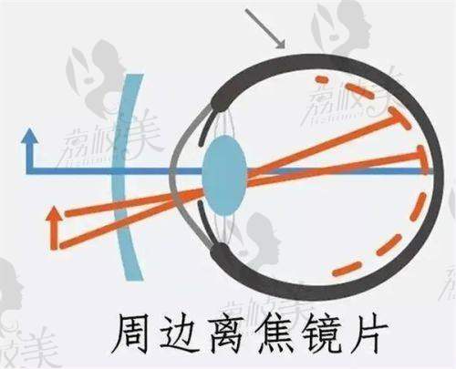 三、北京爱尔英智眼科医院骨干医生:有名骨干医生汇聚之地