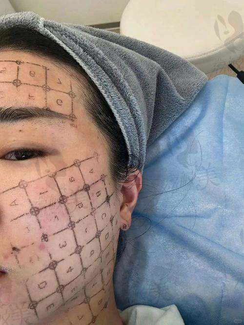 绝了！海南海口会美医疗美容门诊部庞慧芬医生实力超群