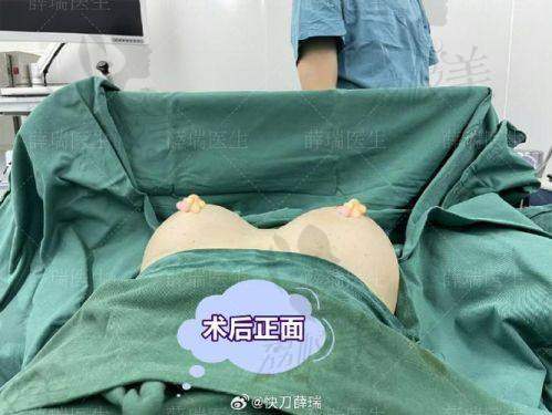 重庆当代10.28美胸超级骨干医生日：与陈育哲医生共赴澎湃之约，开启自信蜕变！