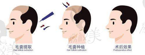 嘉兴曙光公主双十一秒杀799元起！填充塑形优选，限时抢购不容错过！