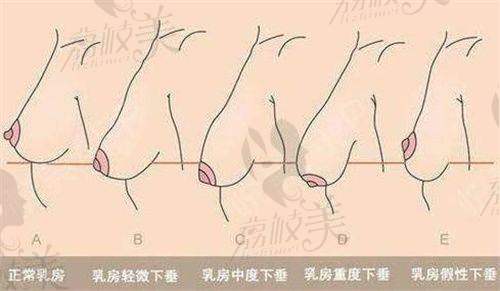 3. 鼻部整形——隆鼻价格 3900 - 29200 元起