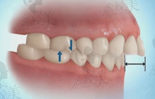 深圳新沙河山口腔门诊部特色服务项目