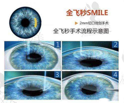 重庆大坪医院眼科预约挂号攻略！放号时间、抢号法则及多种挂号方式全揭秘