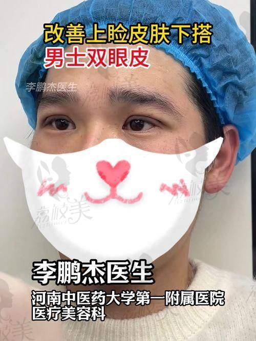 杜克祥医生:常德蔻妍的双眼皮“魔法大师”