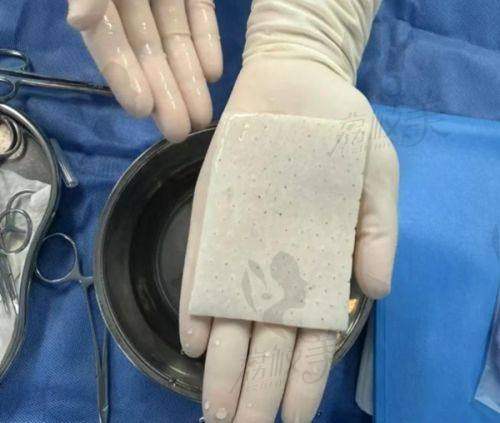 嘉兴曙光AOPT全模式49元起!双十一秒条价,光子嫩肤性价比之王限时抢购中!