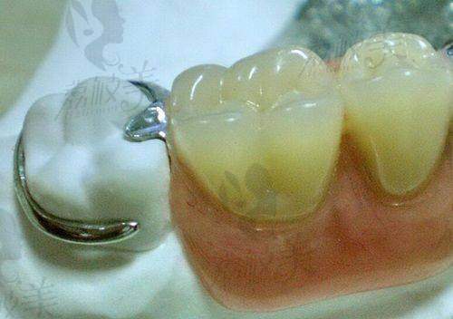 【乌鲁木齐于氏天使口腔门诊部是正规的吗】