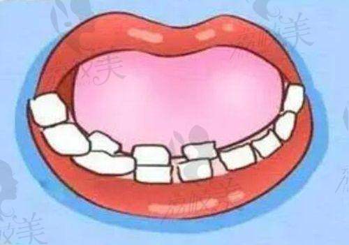 【乌鲁木齐于氏天使口腔门诊部擅长什么项目】