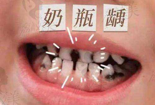 【乌鲁木齐于氏天使口腔门诊部怎么预约挂号】